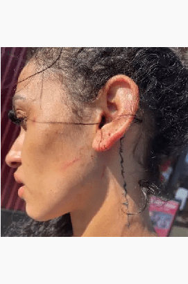 邁爾斯-布里奇斯被控家暴