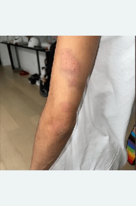 邁爾斯-布里奇斯被控家暴