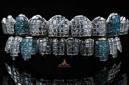 賈·莫蘭特的訂製鑲鑽牙套